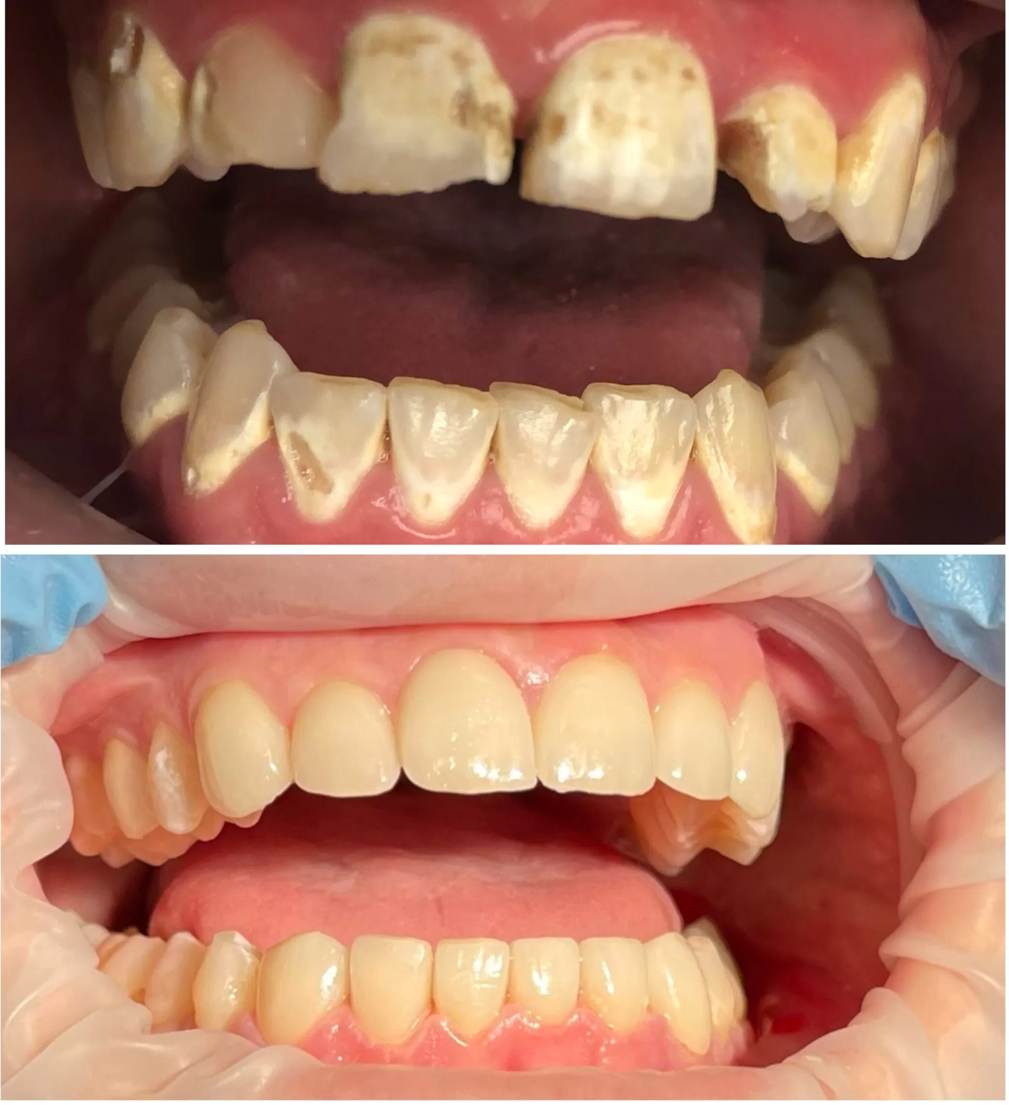Before and After Teeth client picture